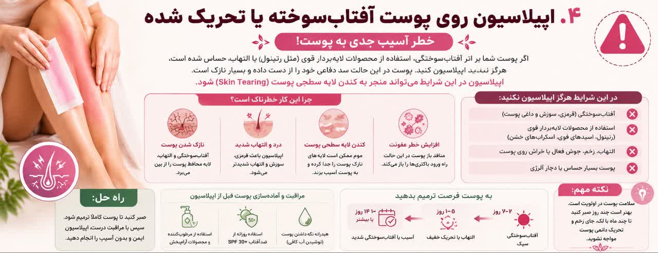 اپیلاسیون روی پوست آفتاب‌سوخته یا تحریک شده